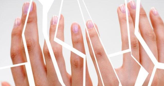 Трескается кожа на руках – ищем причины и устраняем проблему